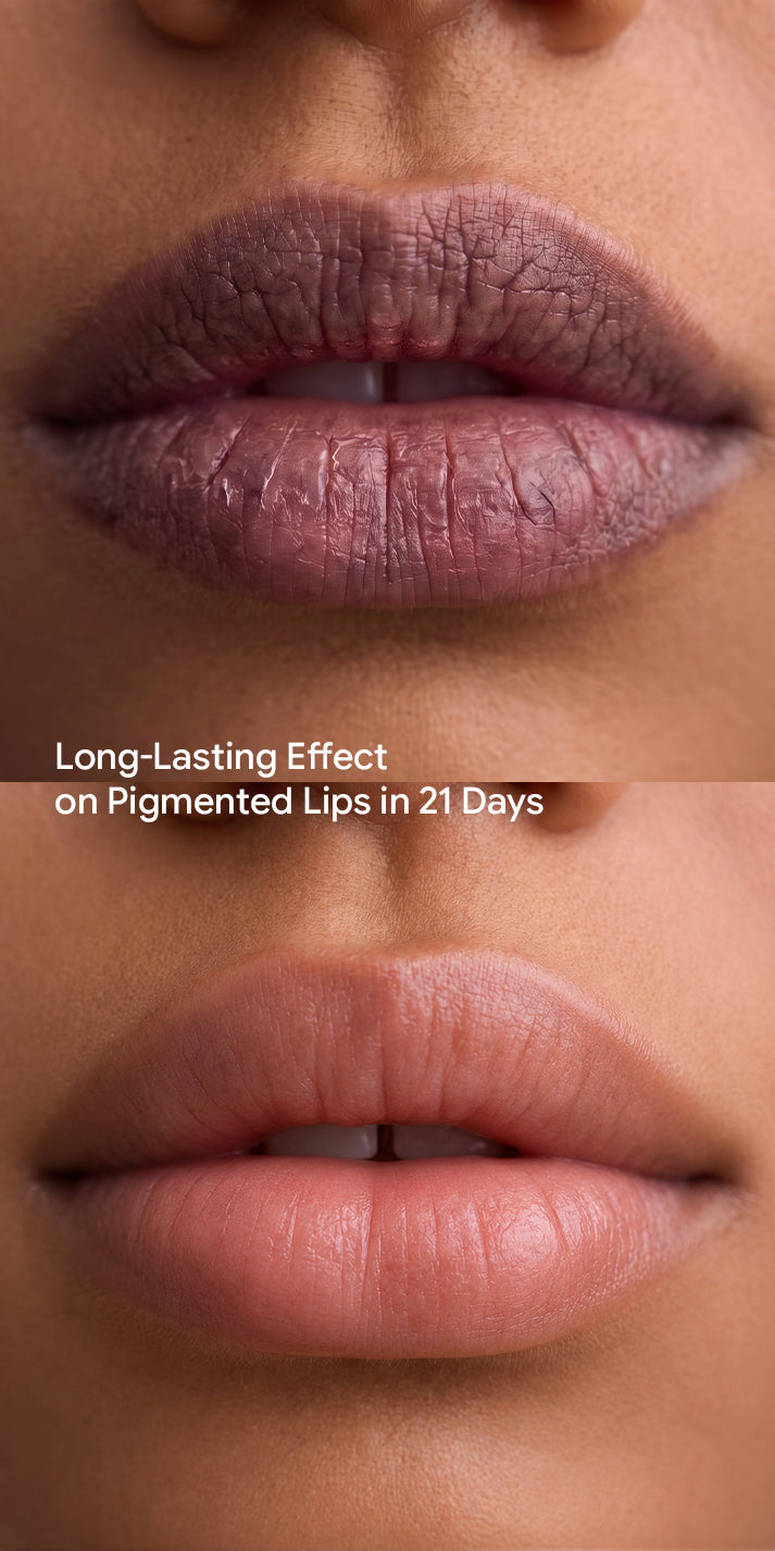 Tinted Lip Injection - Pink Attack